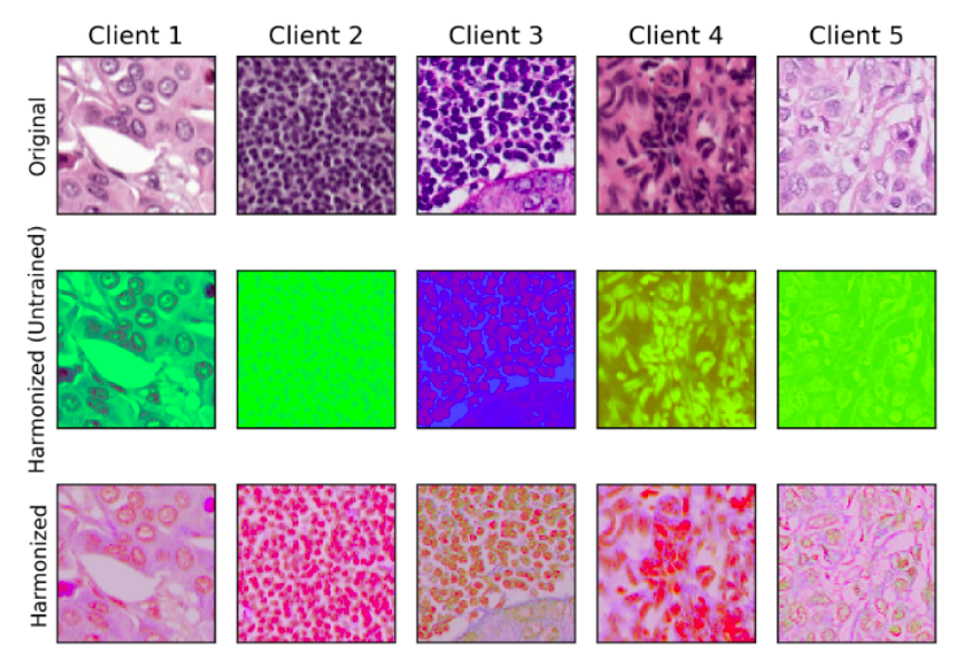 Towards Federated Learning Across Biobanks: Prototype Software from the 2026 Carnegie Mellon University–NVIDIA Hackathon